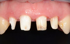 Fig. 15
