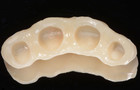 Fig. 16