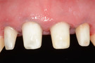 Fig. 18