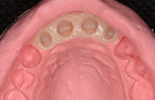 Fig. 19