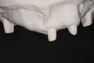 83